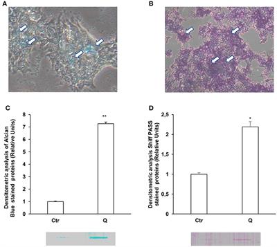 Quercetin Increases MUC2 and MUC5AC Gene Expression and Secretion in Intestinal Goblet Cell-Like LS174T via PLC/PKCα/ERK1-2 Pathway